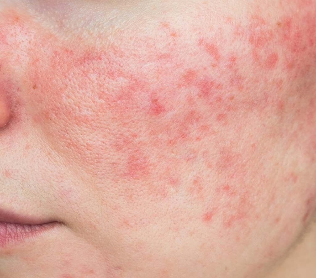 cong-dung-nuoc-vo-gao-5